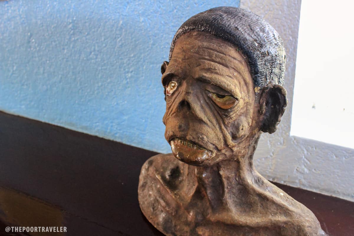 A 3D model of a leprosy patient